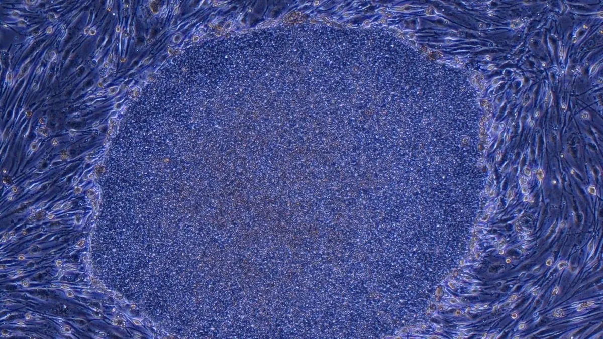 Japans banbrytande godkännande av regenerativ medicin med iPS‑celler